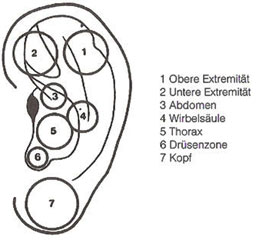 Zeichnung des Ohres mit den verschiedenen Akupunkturpunkten